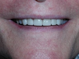 Image after dental service