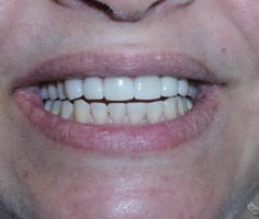 Image after dental service