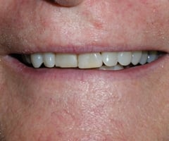 Image before dental service