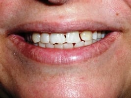 Image before dental service