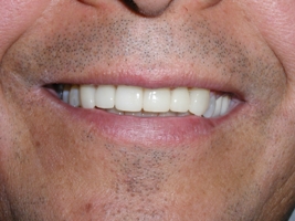 Image after dental service