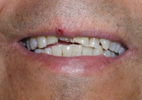 Image before dental service