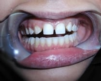 Image before dental service