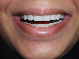 Image after dental service