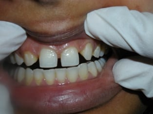 Image before dental service