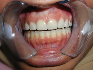 Image after dental service